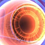 Detailed Step-By-Step Guide To A Cataract Operation